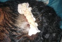 Salah satu Korban pengeroyokan dari kampung Bempo Kec. Lembor pada malam pergantian tahun 2025